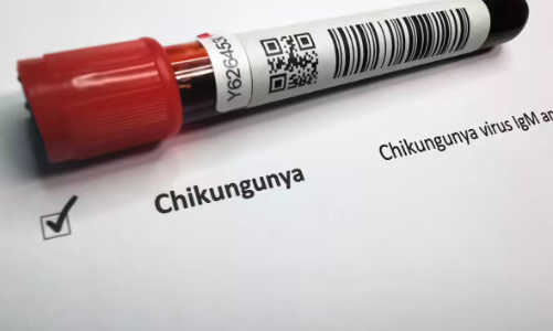 Bệnh chikungunya dễ bị chẩn đoán sai và khó xác định số người nhiễm bệnh