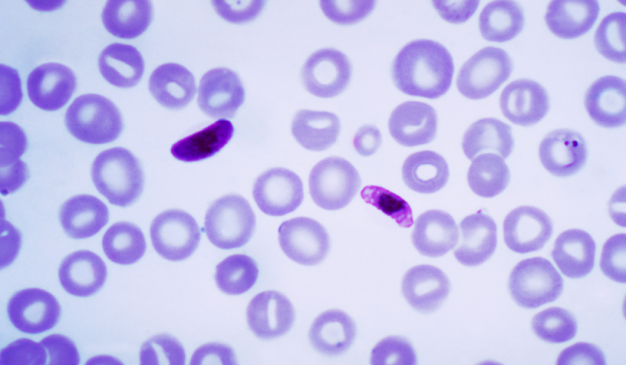 Sốt rét là bệnh truyền nhiễm do ký sinh trùng Plasmodium, lây truyền qua muỗi Anopheles.