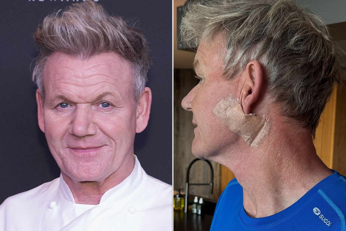 Bếp trưởng&nbsp;Gordon Ramsay thông báo bị ung thư da.