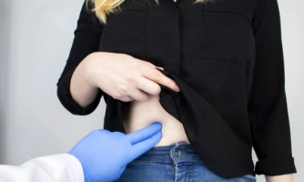 Bác sỹ Việt điều trị thành công nhiều ca sỏi mật khó