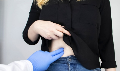 Bác sỹ Việt điều trị thành công nhiều ca sỏi mật khó