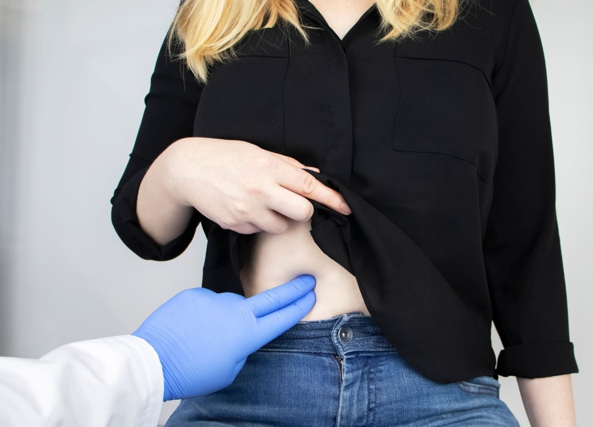 Sỏi mật là bệnh khá phổ biến ở Việt Nam.