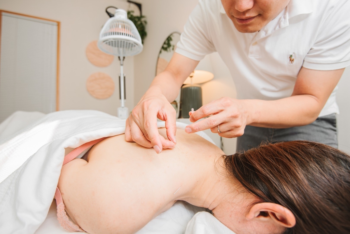 Phương pháp châm cứu tác động trực tiếp vào các huyệt vị giúp điều hòa khí huyết, thông kinh hoạt lạc.