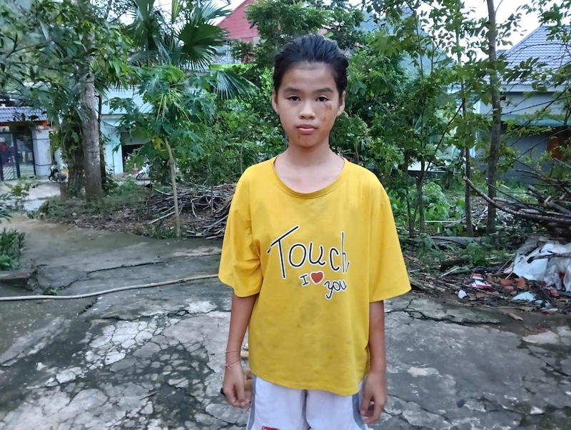 Em Phương bàng hoàng kể lại giây phút sinh tử