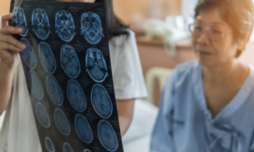 Y học hiện đại “nới rộng” giờ vàng đột quỵ