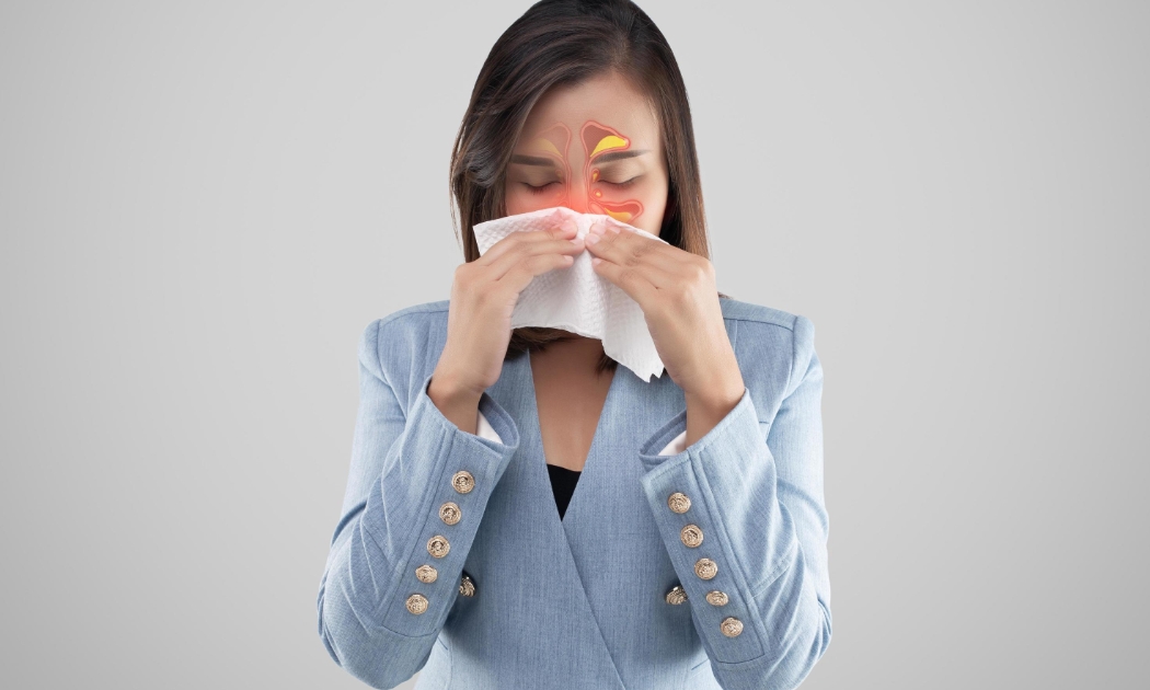 Viêm xoang do nấm có triệu chứng mơ hồ, không điển hình.
