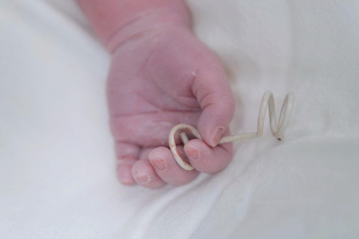 Chiếc shunt – “người bạn đồng hành” đã gắn bó cùng em bé suốt 8 tuần trong bụng mẹ.