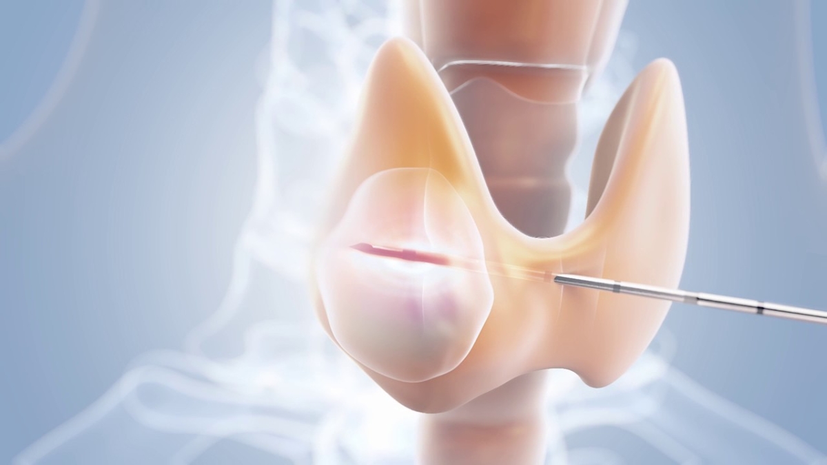 Hiếm khi một bệnh nhân cùng lúc mắc ung thư ở hai cơ quan khác nhau, với bản chất mô học tách biệt.