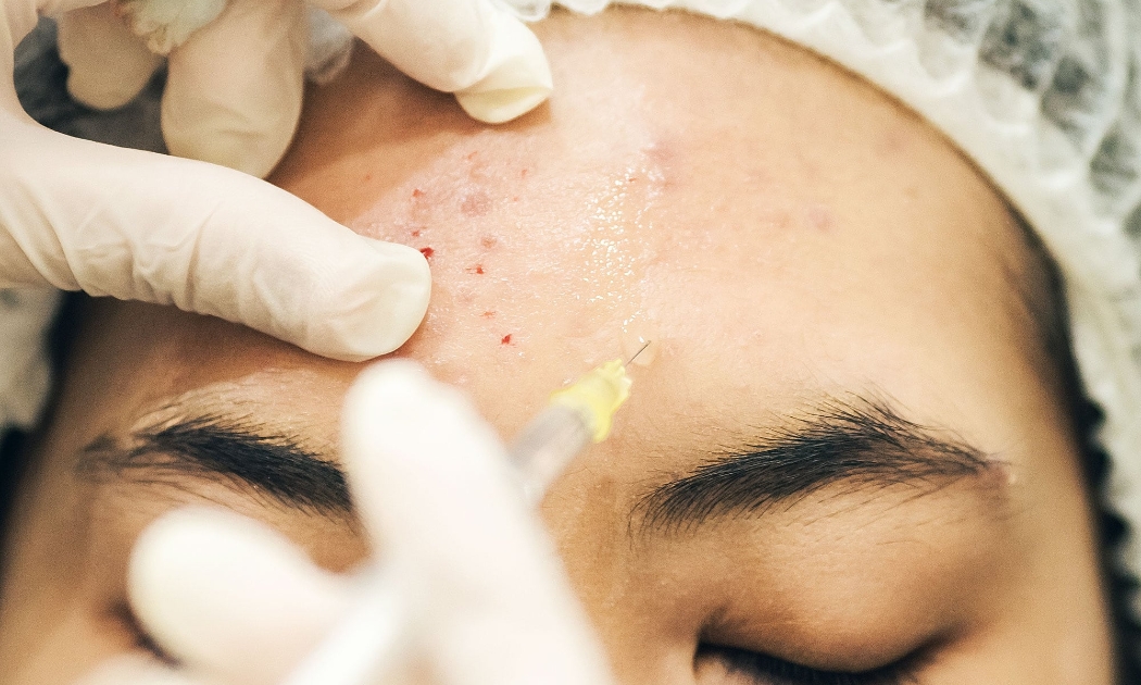 Bệnh viện tiếp nhận nhiều ca biến chứng sau tiêm thẩm mỹ