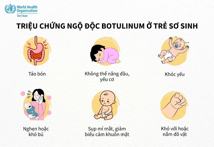 Triệu chứng ngộ độc botulinum ở trẻ sơ sinh. Nguồn: WHO. 