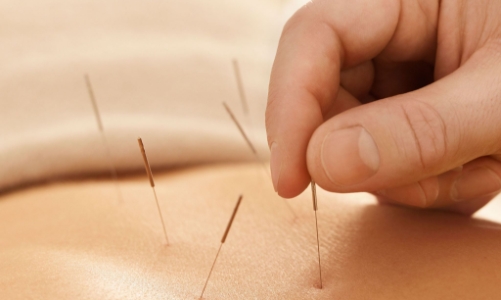 Y học cổ truyền tiến vào kỷ nguyên chuẩn hóa và khoa học