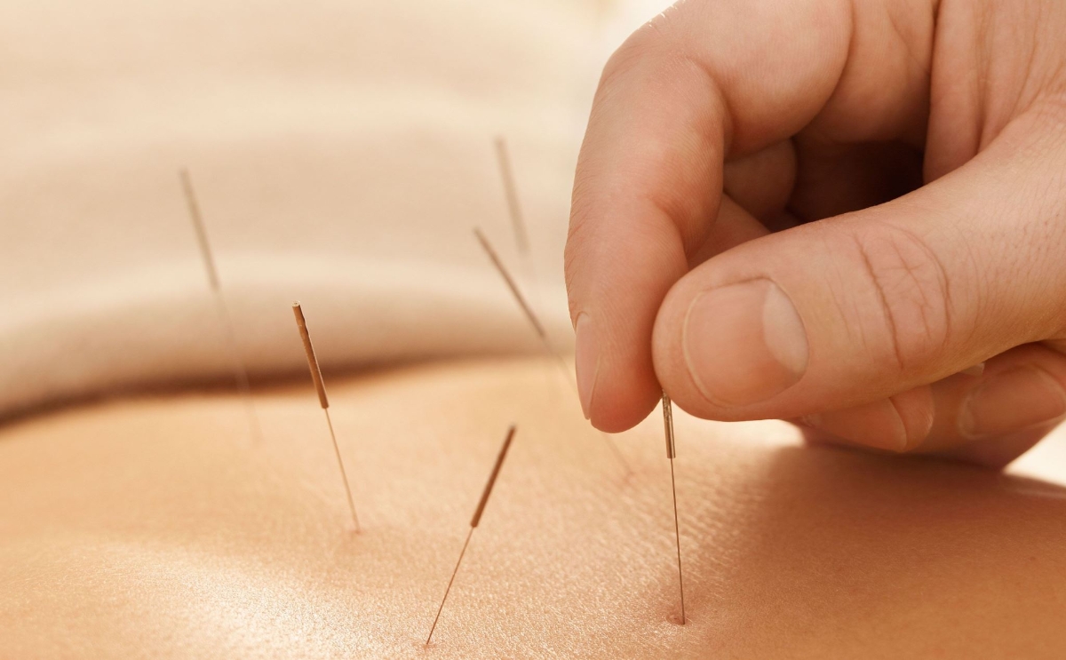 Nghị quyết 72 của Bộ Chính trị xác định y học cổ truyền là một trong ba trụ cột quan trọng của nền y tế hiện đại.