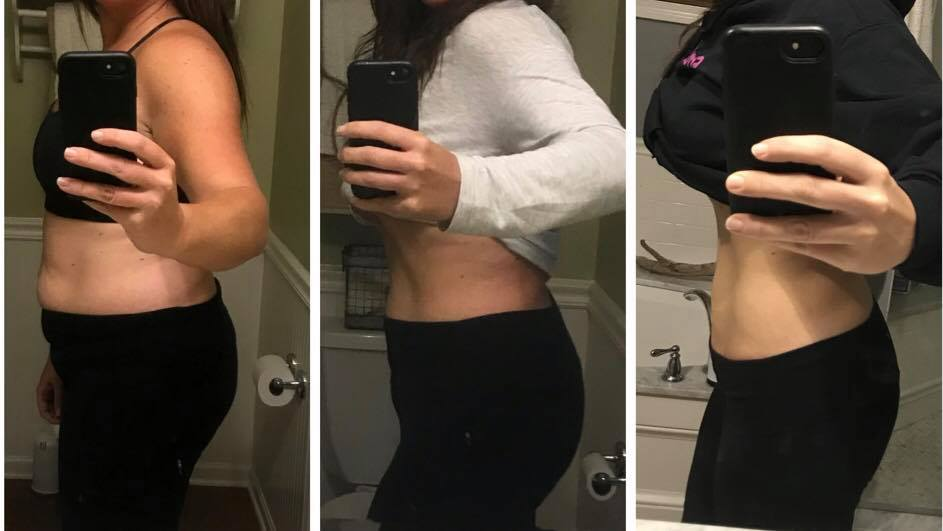 Tình trạng này dễ xảy ra ở những người giảm cân theo phác đồ mạnh.