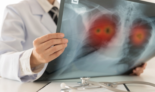 Ba trụ cột phát triển lĩnh vực y tế tim mạch Việt Nam