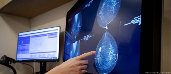 Chụp nhũ ảnh tiêu chuẩn không phải lúc nào cũng phát hiện ung thư vú đủ sớm - Ảnh: Robin van Ronkhuijsen/ANP/IMAG