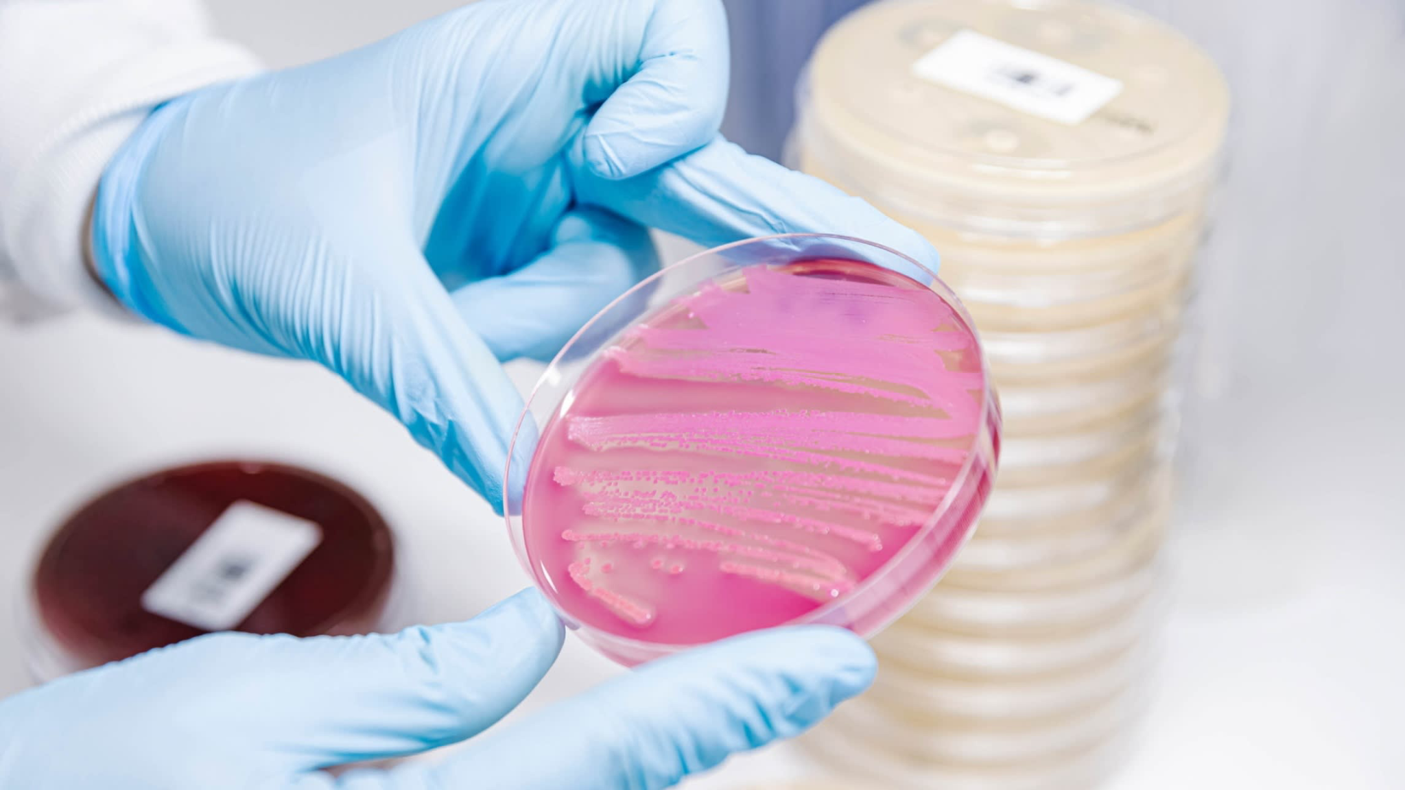 Sự phát triển của vi sinh vật trong đĩa Petri. Ảnh: JDSMuro/Getty Images