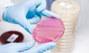 Sự phát triển của vi sinh vật trong đĩa Petri. Ảnh: JDSMuro/Getty Images