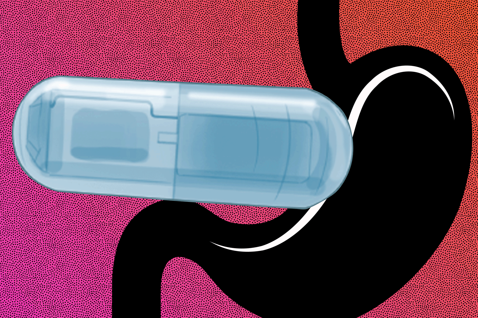 Điều trị bệnh béo phì cần một liệu trình toàn diện