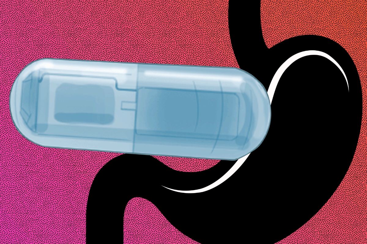 Tỉ lệ tử vong do tim mạch và đột quỵ ở người béo phì đang có xu hướng gia tăng nhanh chóng.