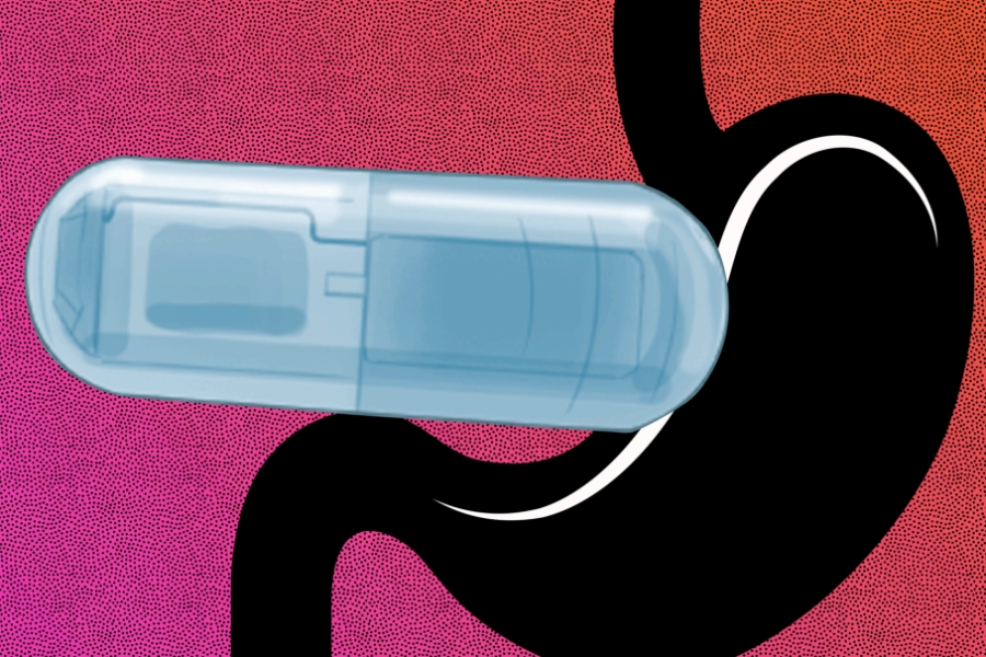 Tỉ lệ tử vong do tim mạch và đột quỵ ở người béo phì đang có xu hướng gia tăng nhanh chóng.