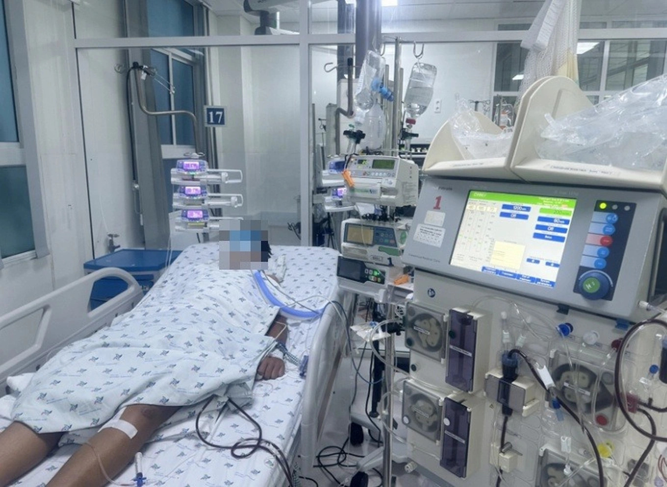 Bệnh nhi N.Đ.N.Đ nhập viện Bệnh viện Nhi đồng Thành phố trong tình trạng nguy kịch. 