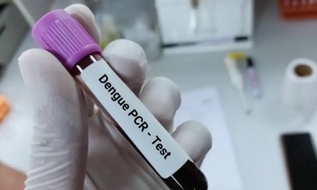 Các bác sĩ nhận định chủng Dengue 2 năm nay gây diễn tiến nặng nhanh.