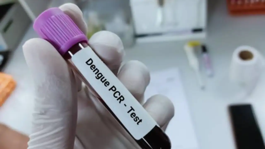 Các bác sĩ nhận định chủng Dengue 2 năm nay gây diễn tiến nặng nhanh.