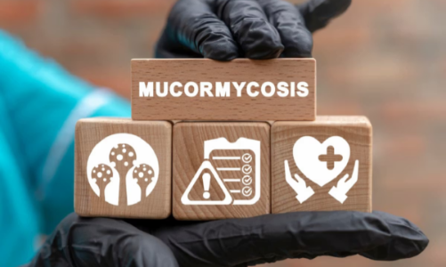 Nhiễm nấm đen xâm lấn: Dấu hiệu dễ nhầm với uốn ván