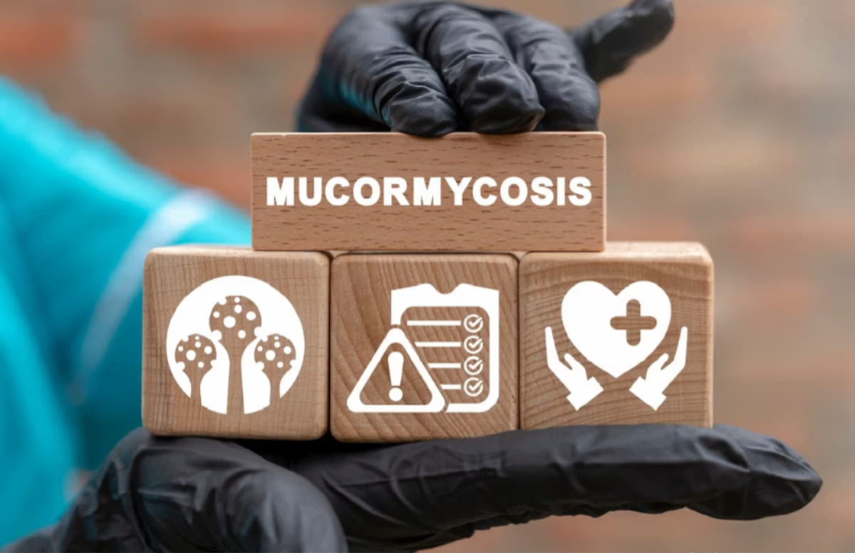 Từ sau đại dịch Covid-19, các bác sĩ bắt đầu phát hiện và điều trị các bệnh nhân bị nhiễm nấm đen với bệnh cảnh phức tạp.
