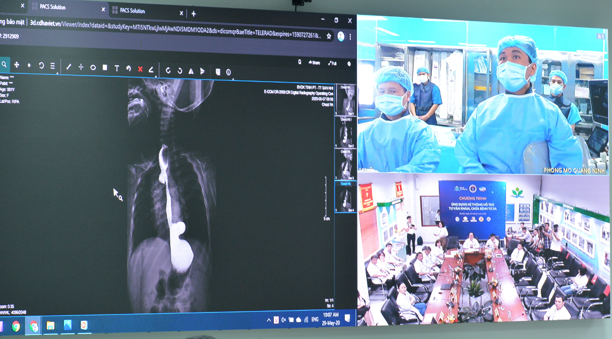 Bệnh viện Nhi Trung ương và Bệnh viện Sản nhi Quảng Ninh cùng cứu chữa cho một bệnh nhi&nbsp;hẹp van tim động mạch phổi.&nbsp;