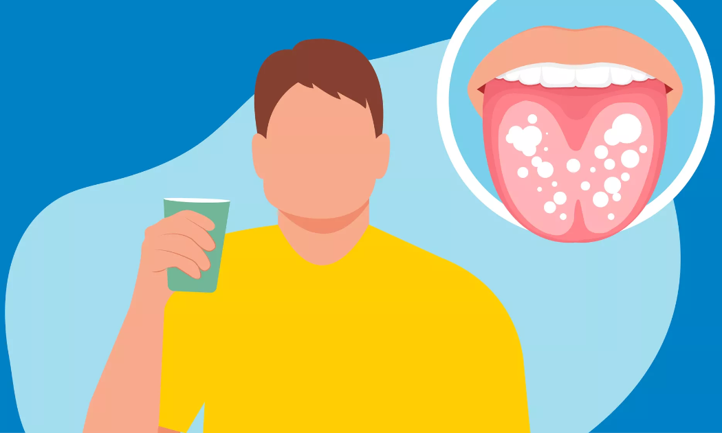 Người Việt còn chủ quan với bệnh lý răng miệng