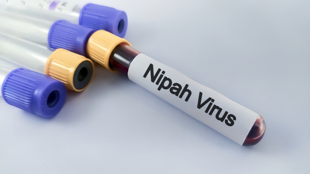 Điểm nguy hiểm nhất của Nipah là biến chứng viêm não.