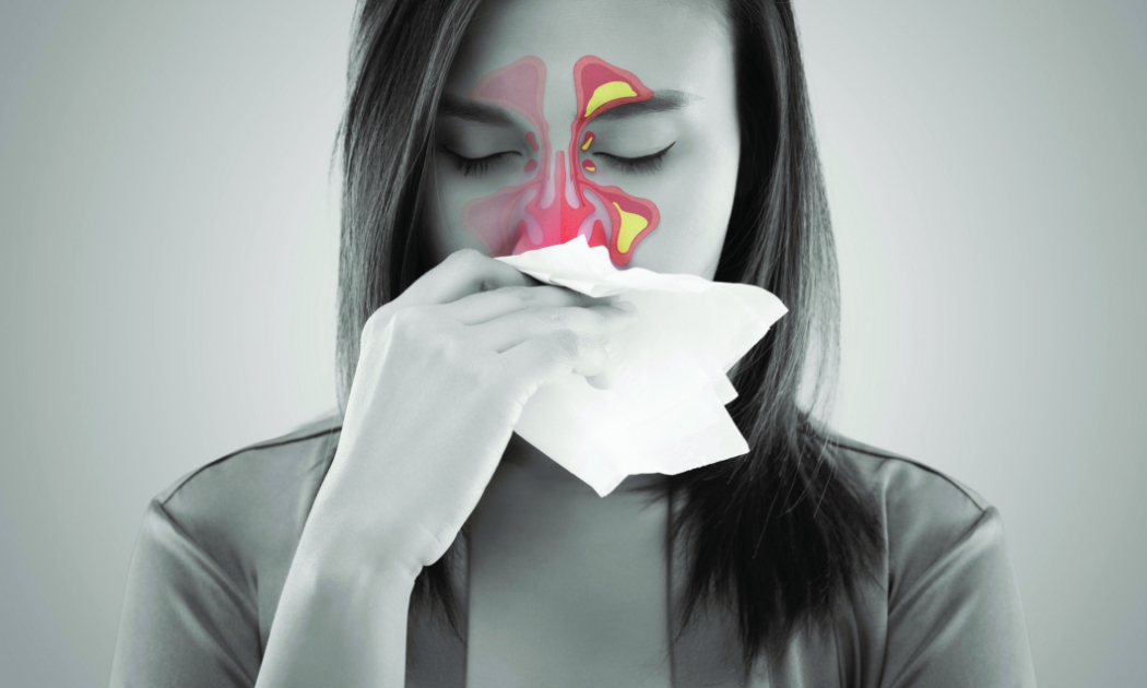 Sai lầm khi tự chữa viêm xoang theo “bác sĩ mạng”