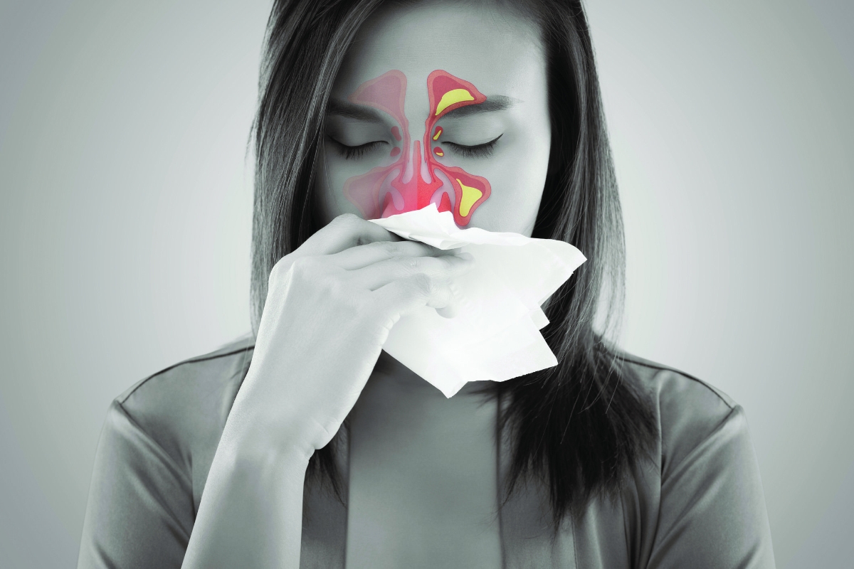 Sai lầm phổ biến của bệnh nhân viêm xoang sử dụng thuốc co mạch tại chỗ khi bị ngạt mũi.