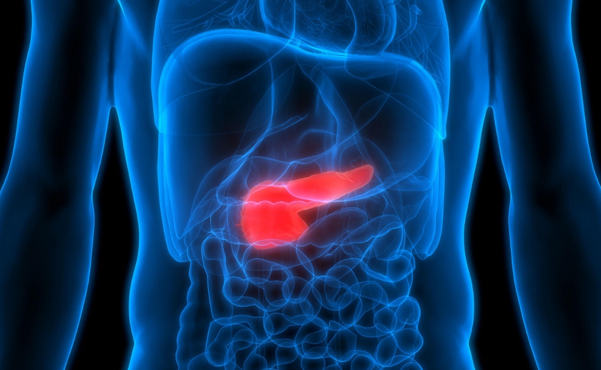 Viêm tụy cấp do rượu thường gặp ở người uống rượu nhiều, kéo dài.&nbsp;