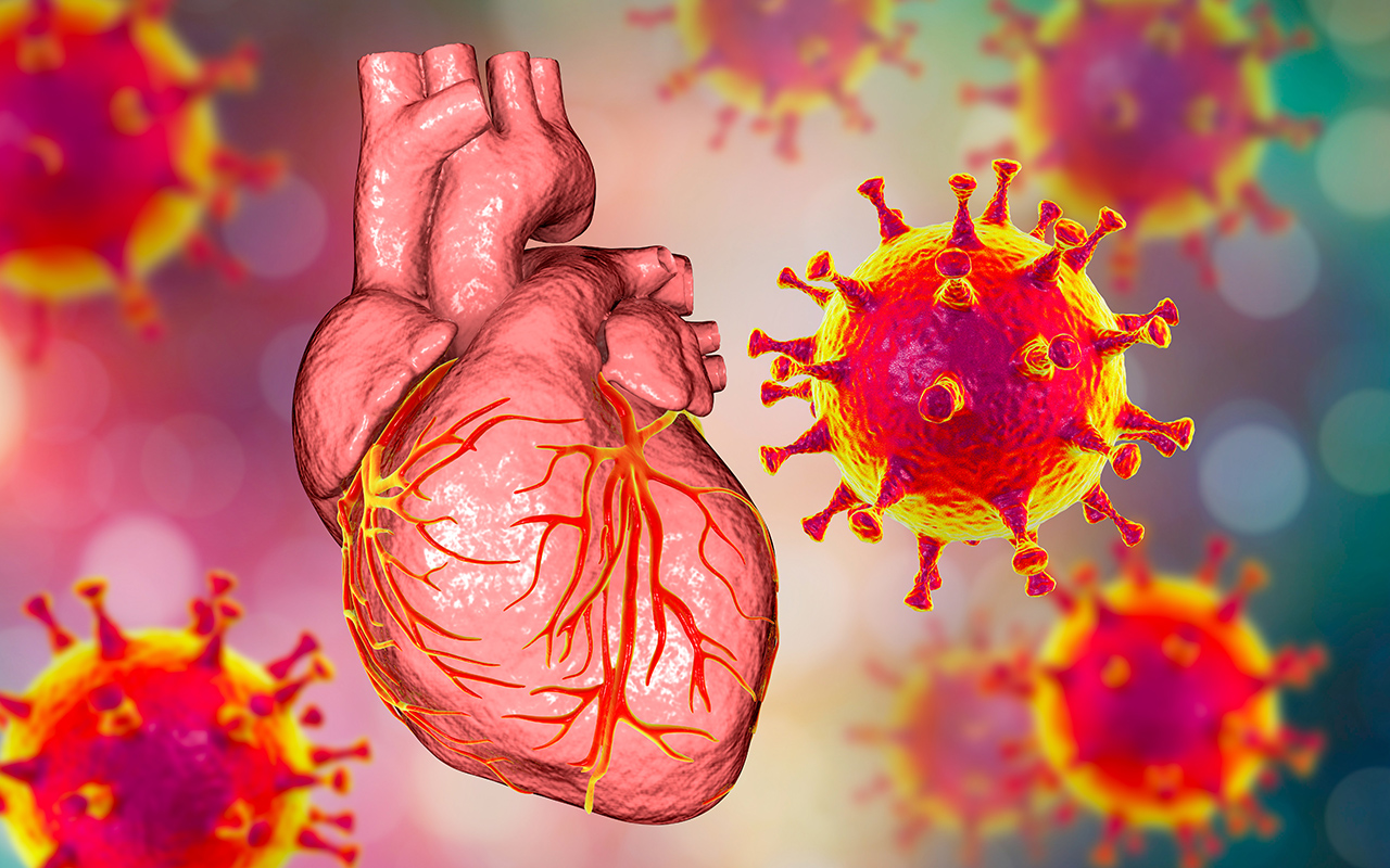 Trong một số trường hợp, virus gây sốt siêu vi không chỉ tấn công đường hô hấp mà còn xâm nhập trực tiếp vào tế bào cơ tim.