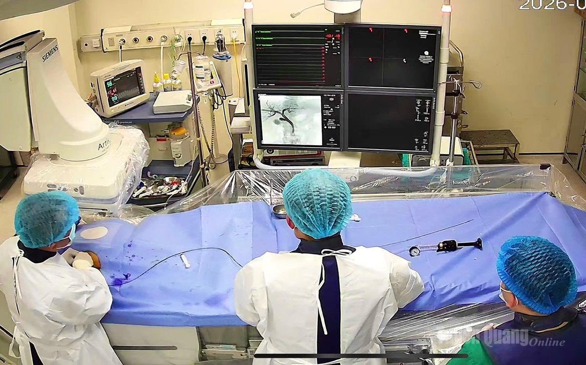 Ca can thiệp được các y, bác sỹ thực hiện bằng kỹ thuật lấy bóng nong.