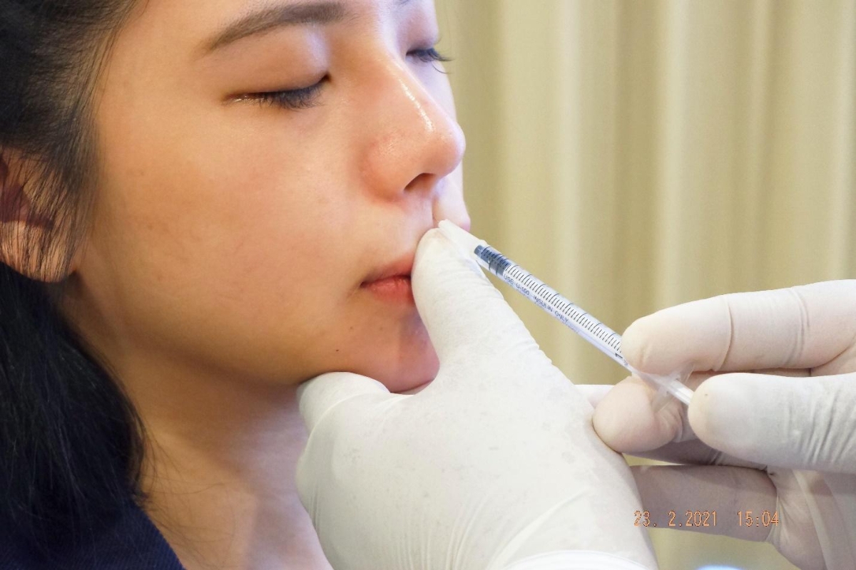 Khách hàng trải dài từ sinh viên ngoài 20 tuổi đến phụ nữ trung niên, với cùng mong muốn “đẹp nhanh đón Tết”.