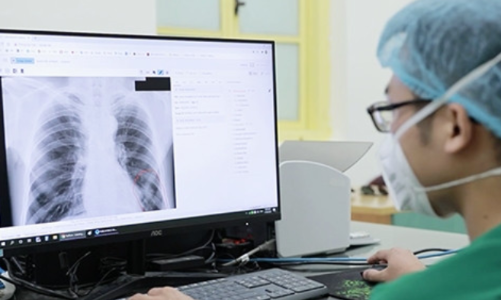 Bộ Y tế phản hồi việc từ chối thanh toán bảo hiểm y tế khi chụp X-quang dưới 6 phút