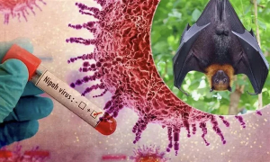 Bộ Y tế hướng dẫn chẩn đoán và điều trị bệnh do virus Nipah