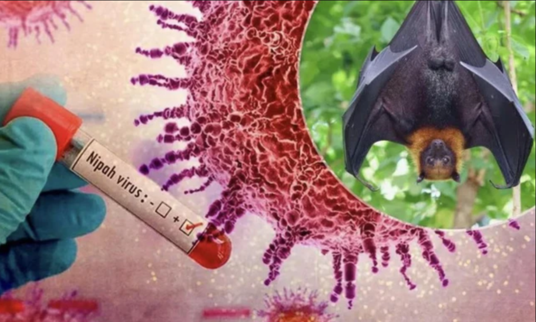Bộ Y tế hướng dẫn chẩn đoán và điều trị bệnh do virus Nipah