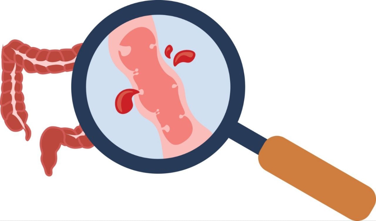 Việc tự ý mua thuốc điều trị có thể khiến bệnh âm thầm tiến triển nặng.