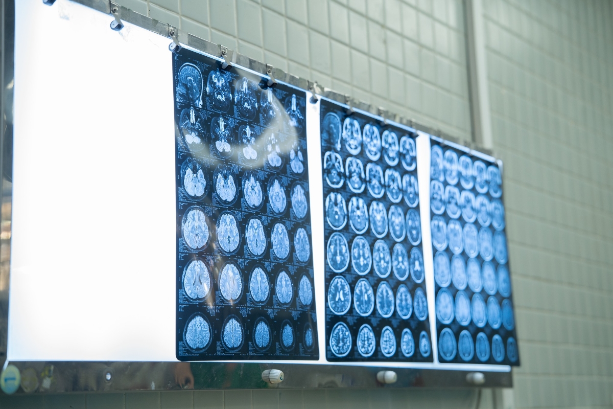 Ảnh: Bệnh viện Chợ Rẫy