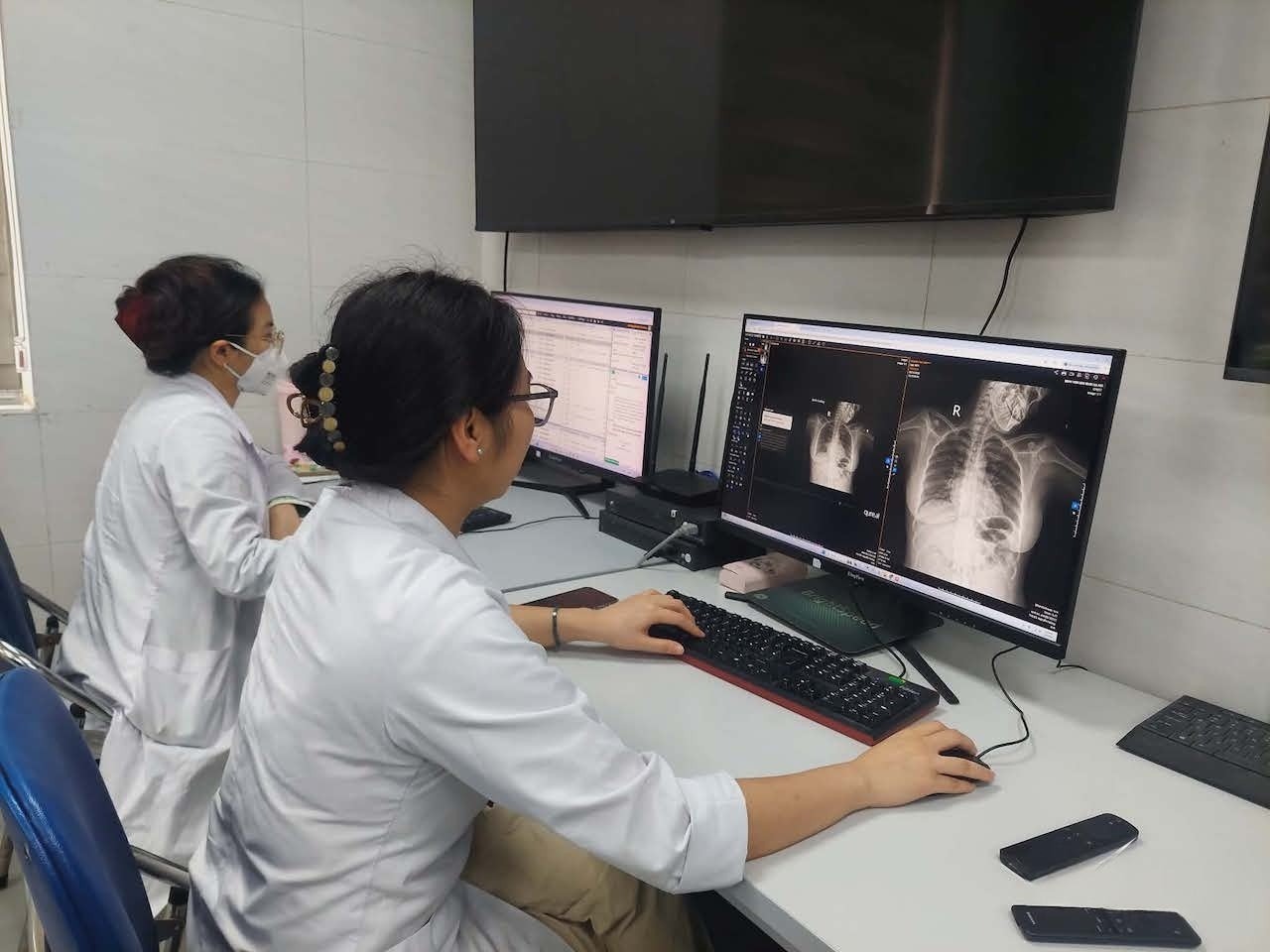 Các bác sĩ Bệnh viện Ung bướu Hà Nội áp dụng AI trong đọc kết quả phim.