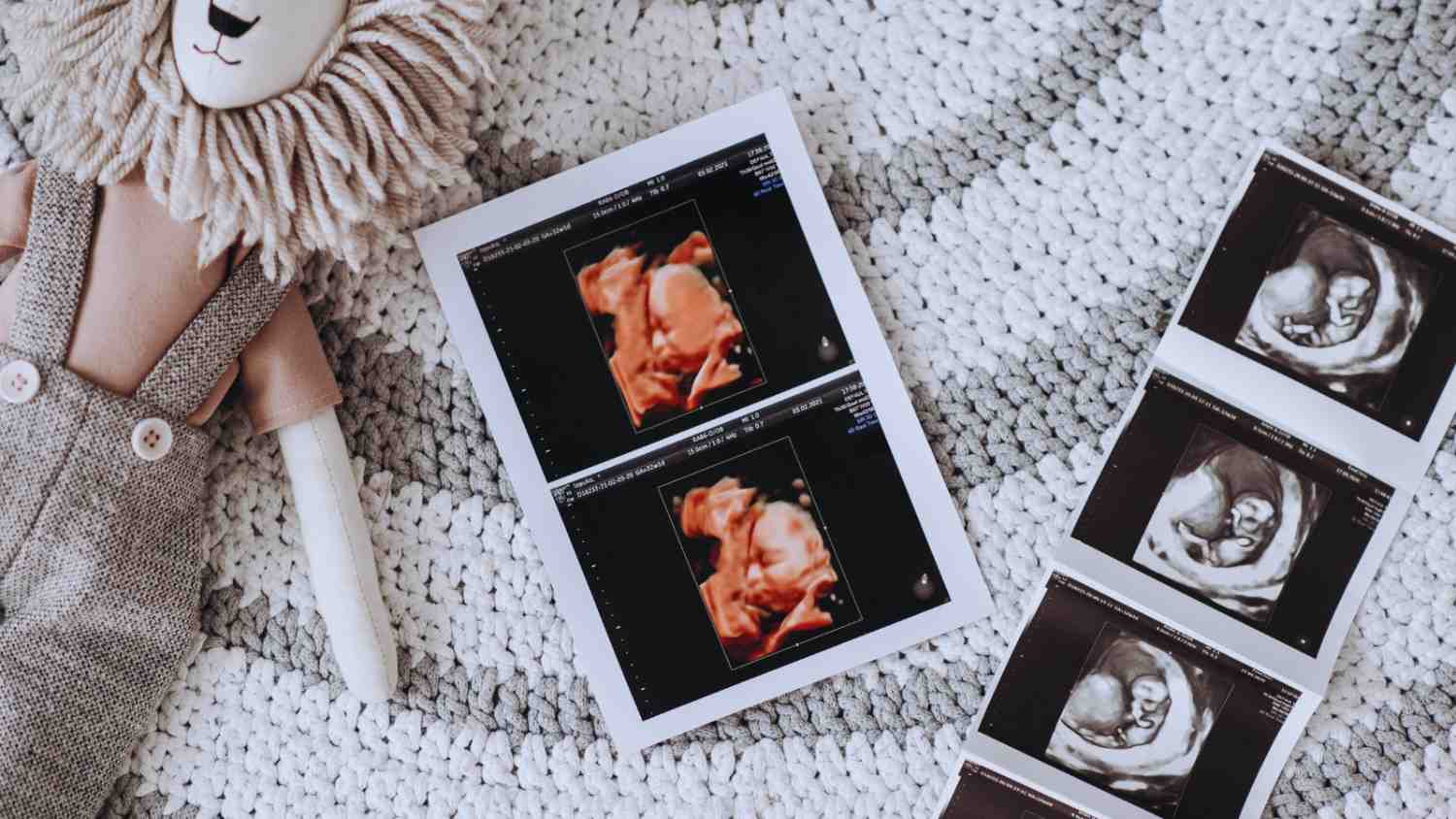 Hiện nay, các xét nghiệm sàng lọc gene được ứng dụng rộng rãi trong khám tiền hôn nhân, trước mang thai.