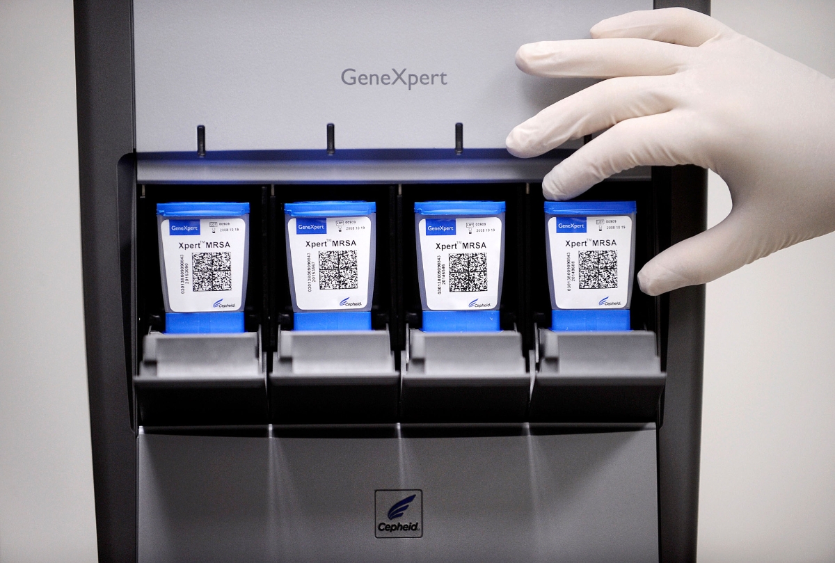 Với các trường hợp nghi ngờ, xét nghiệm GeneXpert sẽ giúp chẩn đoán xác định nhanh chóng và chính xác.