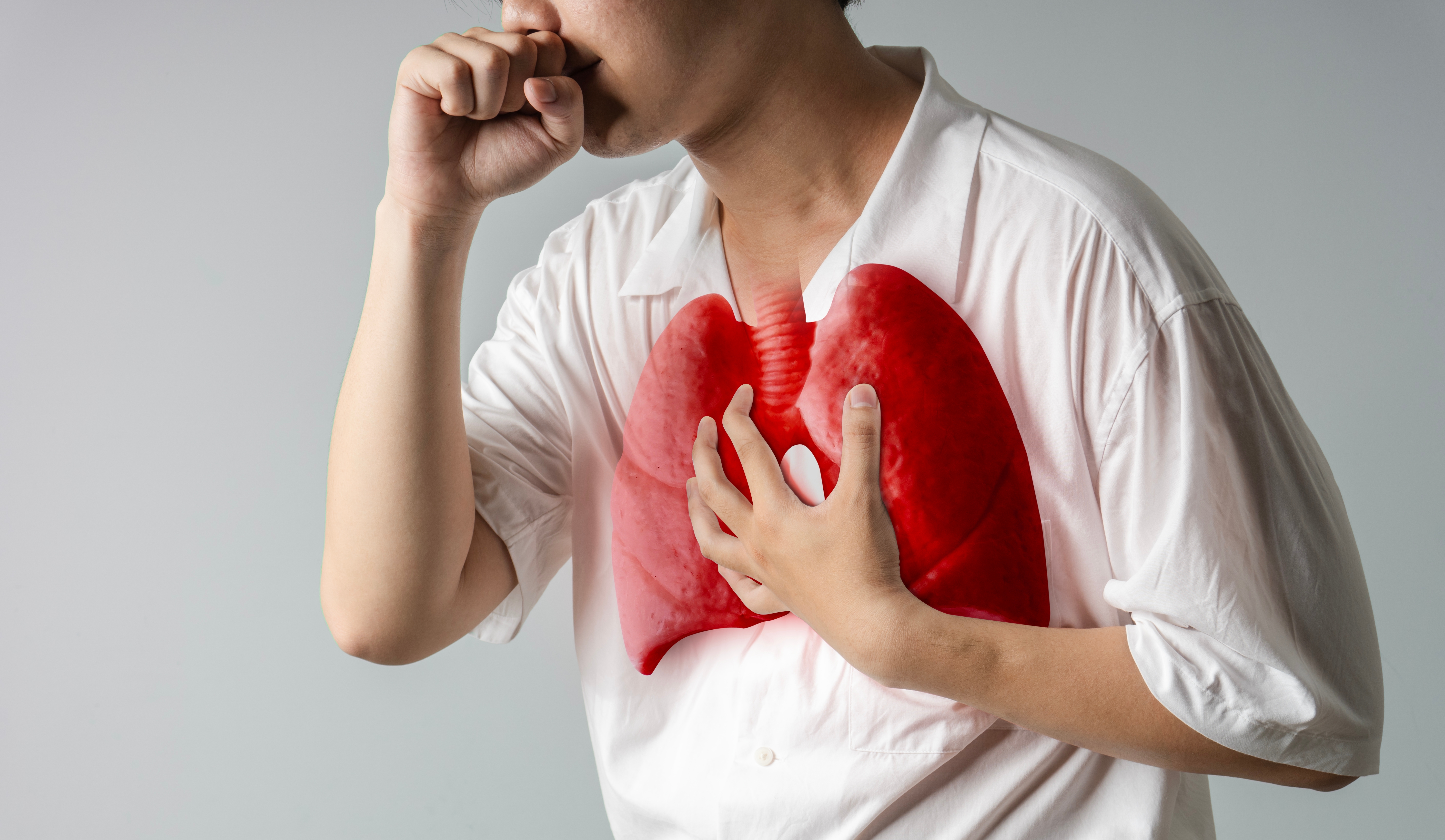 Số người không được khám sàng lọc bệnh lao ước tính khoảng 40 - 50% dân số hiện nay.