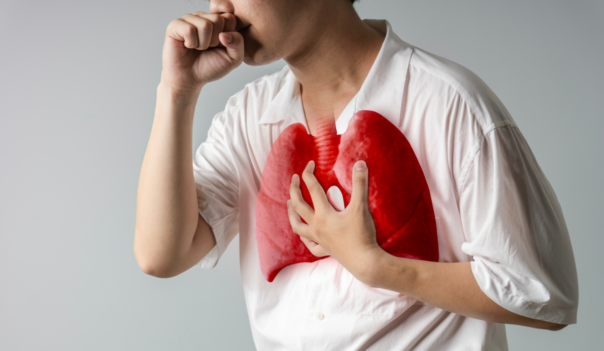 Số người không được khám sàng lọc bệnh lao ước tính khoảng 40 - 50% dân số hiện nay.