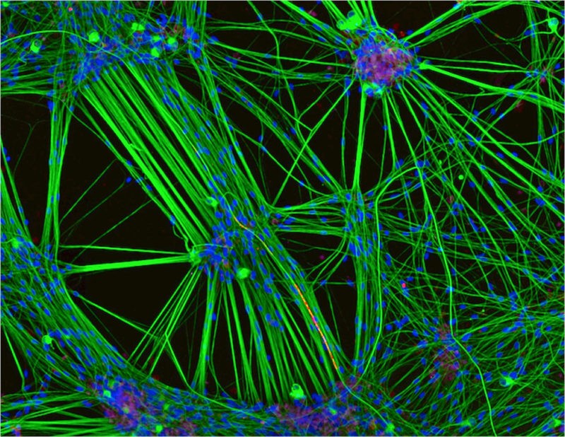 Các neuron người được nuôi cấy trong phòng thí nghiệm, hiển thị mạng lưới kết nối phức tạp giữa các tế bào thần kinh - nền tảng cho các nghiên cứu điện toán sinh học và công nghệ “wetware”. Nguồn: Nikon Small World/Leica Microsystems