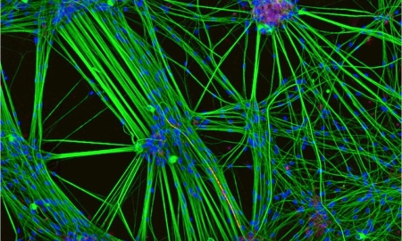 Các neuron người được nuôi cấy trong phòng thí nghiệm, hiển thị mạng lưới kết nối phức tạp giữa các tế bào thần kinh - nền tảng cho các nghiên cứu điện toán sinh học và công nghệ “wetware”. Nguồn: Nikon Small World/Leica Microsystems